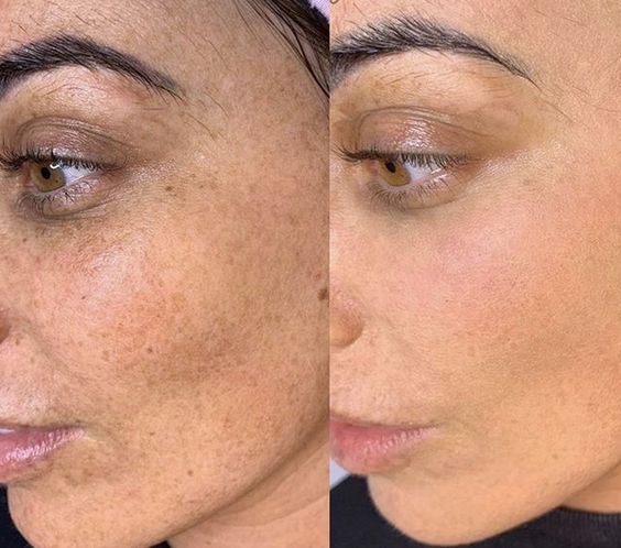 PRISTA Opuluxa – Vitamin C 2% + (Vitamin B3)