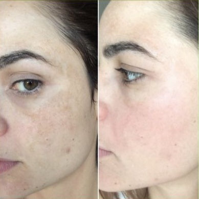 PRISTA Regaliax – Hyaluronic Acid 2%
