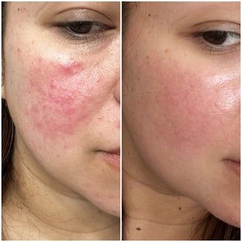 PRISTA Regaliax – Hyaluronic Acid 2%